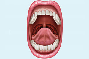 Подрезание уздечки губы и языка